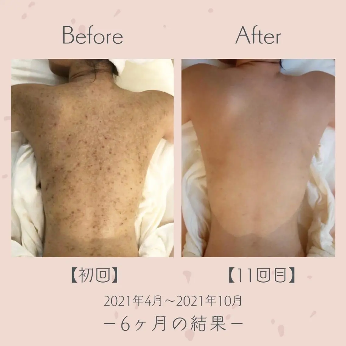 エステ＆美肌脱毛 ココサロ倉敷店のエステ・リラクイメージ