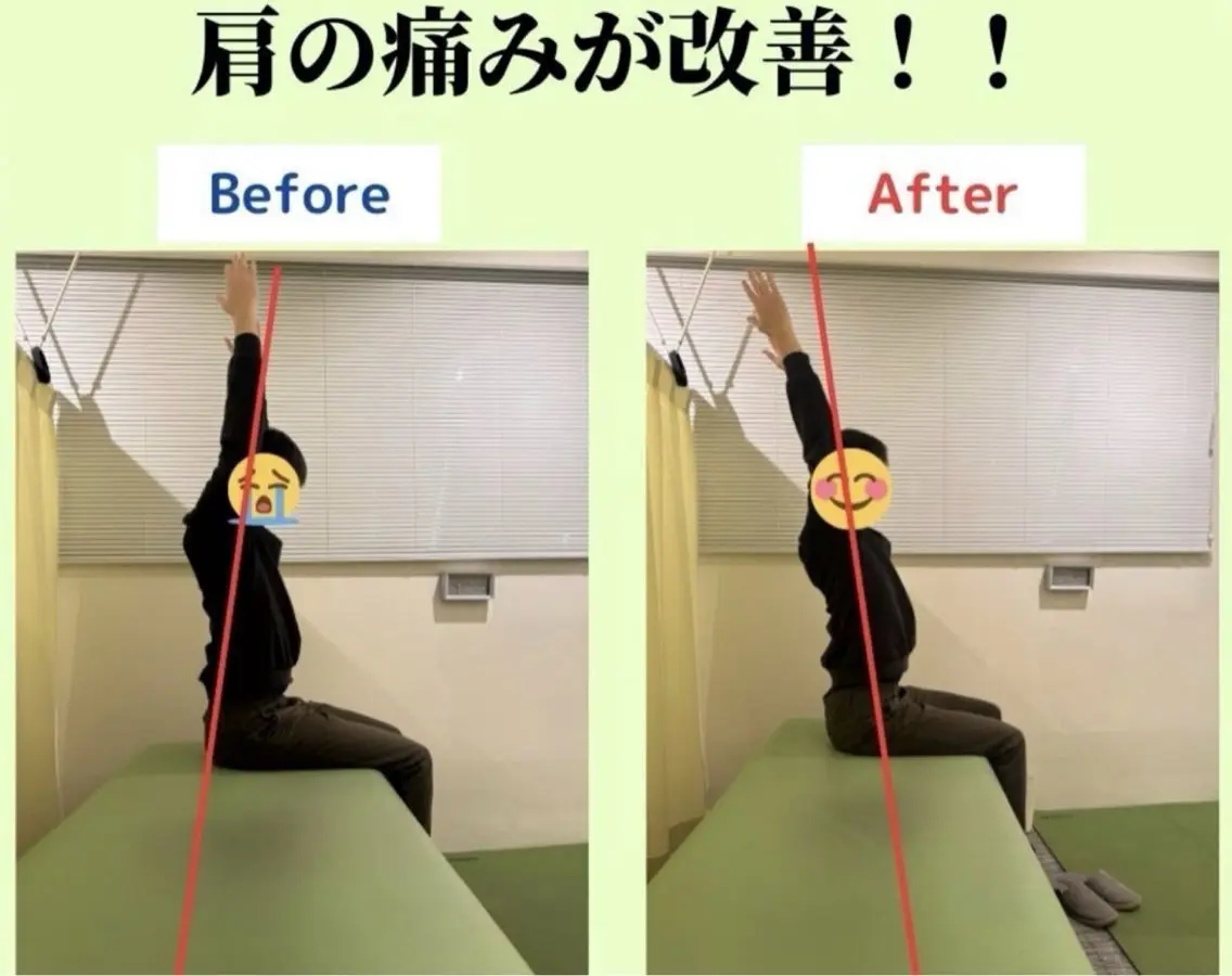 【初回】肩こり･首こり集中整体の写真