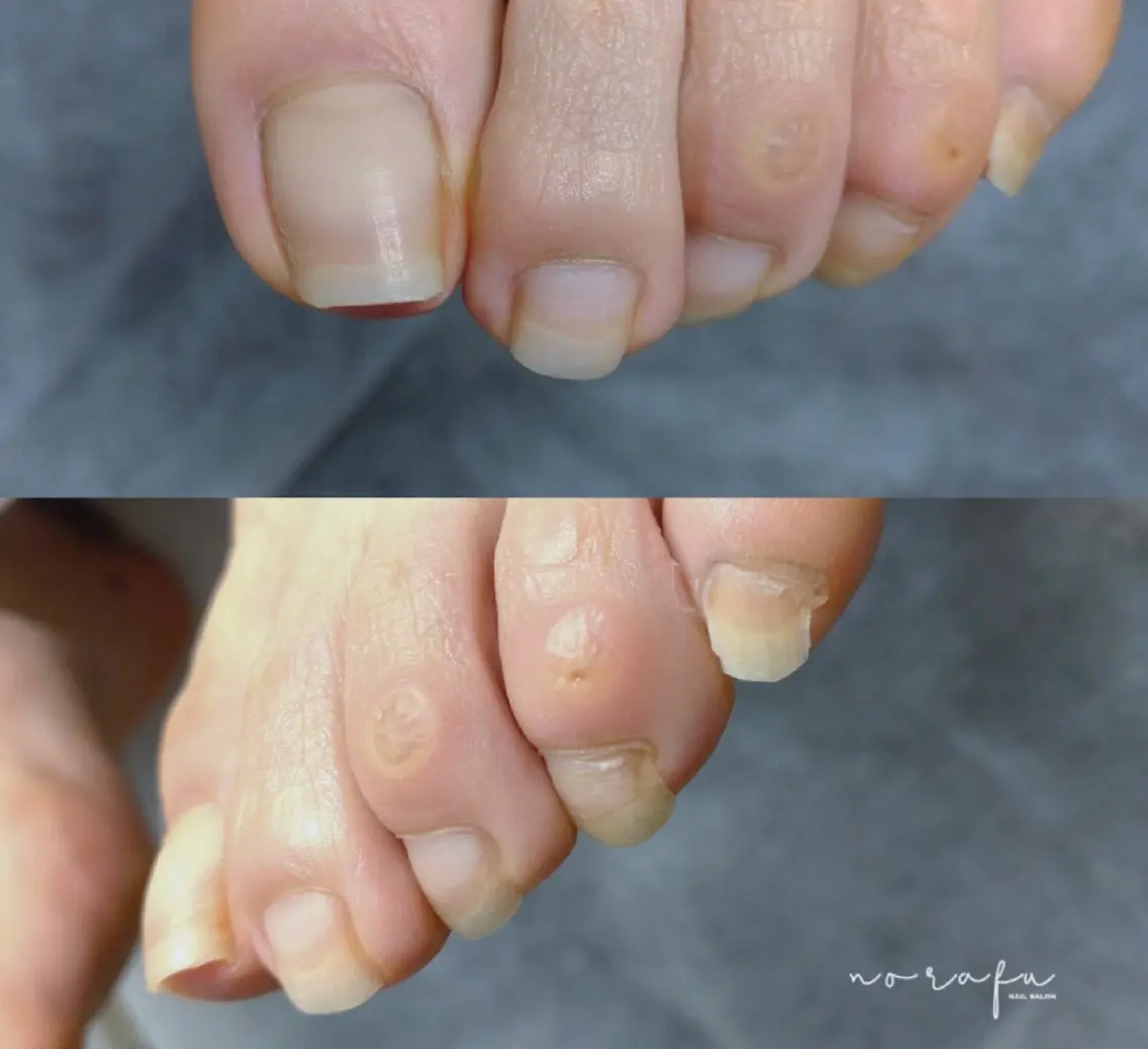 ネイル フットネイル nail 　norafu.のネイルデザイン