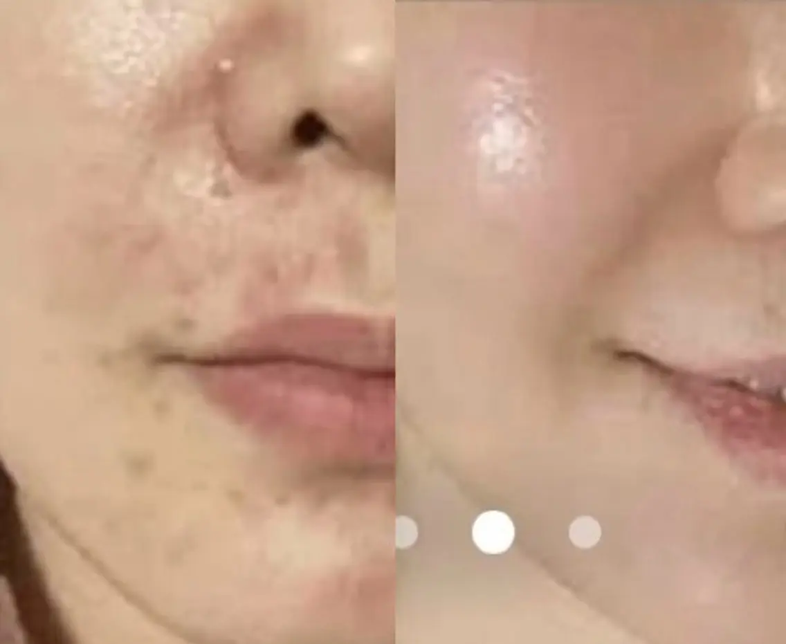 エステ esthesalon O'-en-のエステ・リラクイメージ