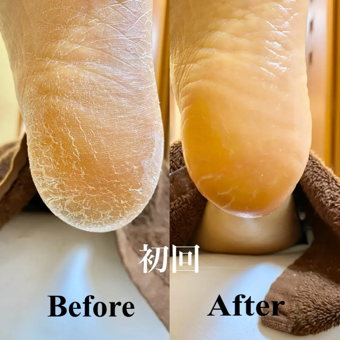 フット角質ケア👣赤ちゃんのようなモチモチ足裏に✨スパルーチェフットケア🌈の写真