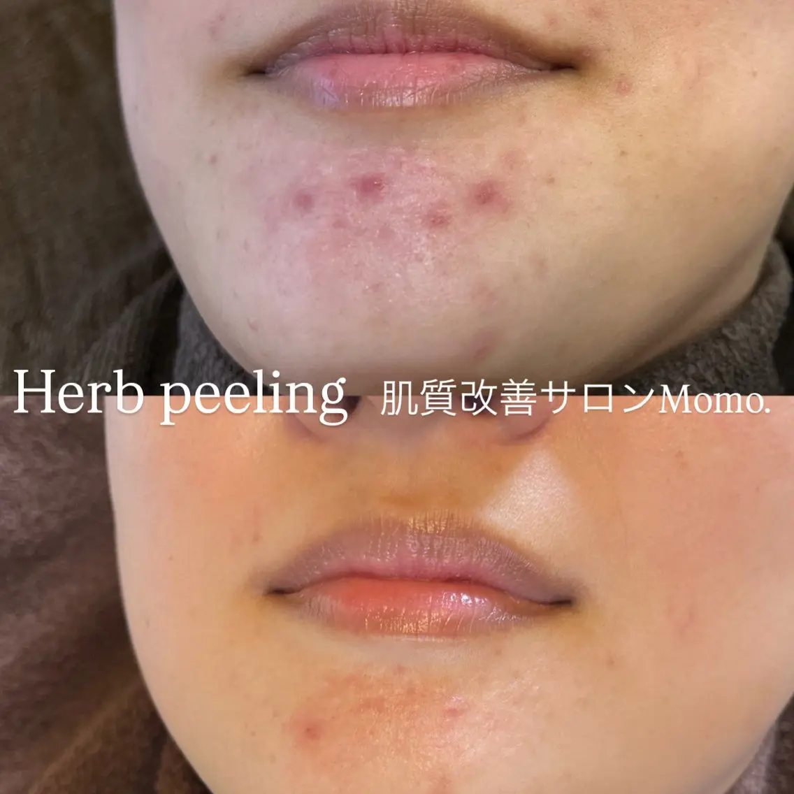 エステ 相模大野のサロン🌿 Momo.のエステ・リラクイメージ
