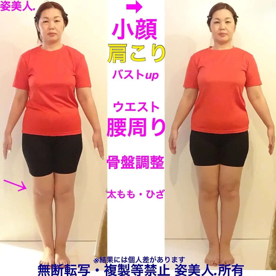 🌼70分🌼全身矯正＋小顔矯正＋食いしばり＋ヘッド筋膜リリース＋歪みチェックの写真