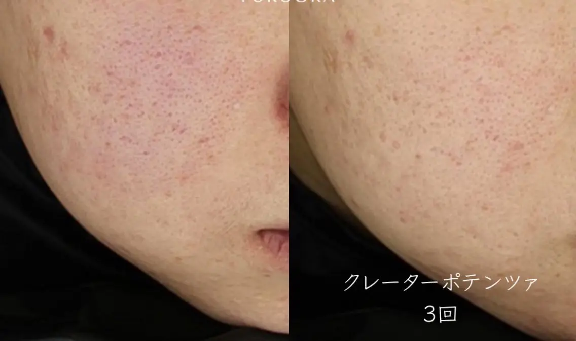 マツエク・マツパ エステ 愛維美水光美肌専門店 メンズレディースokのエステ・リラクイメージ
