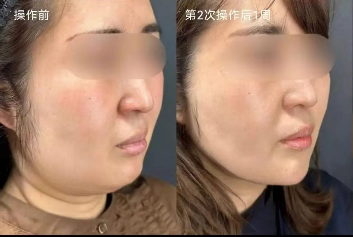 マツエク・マツパ エステ 愛維美水光専門店 川崎彩鳳のエステ・リラクイメージ