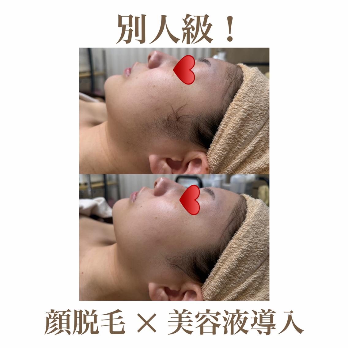 エステ 🫧美肌サロン🫧 レイビスひかる🧡のエステ・リラクイメージ