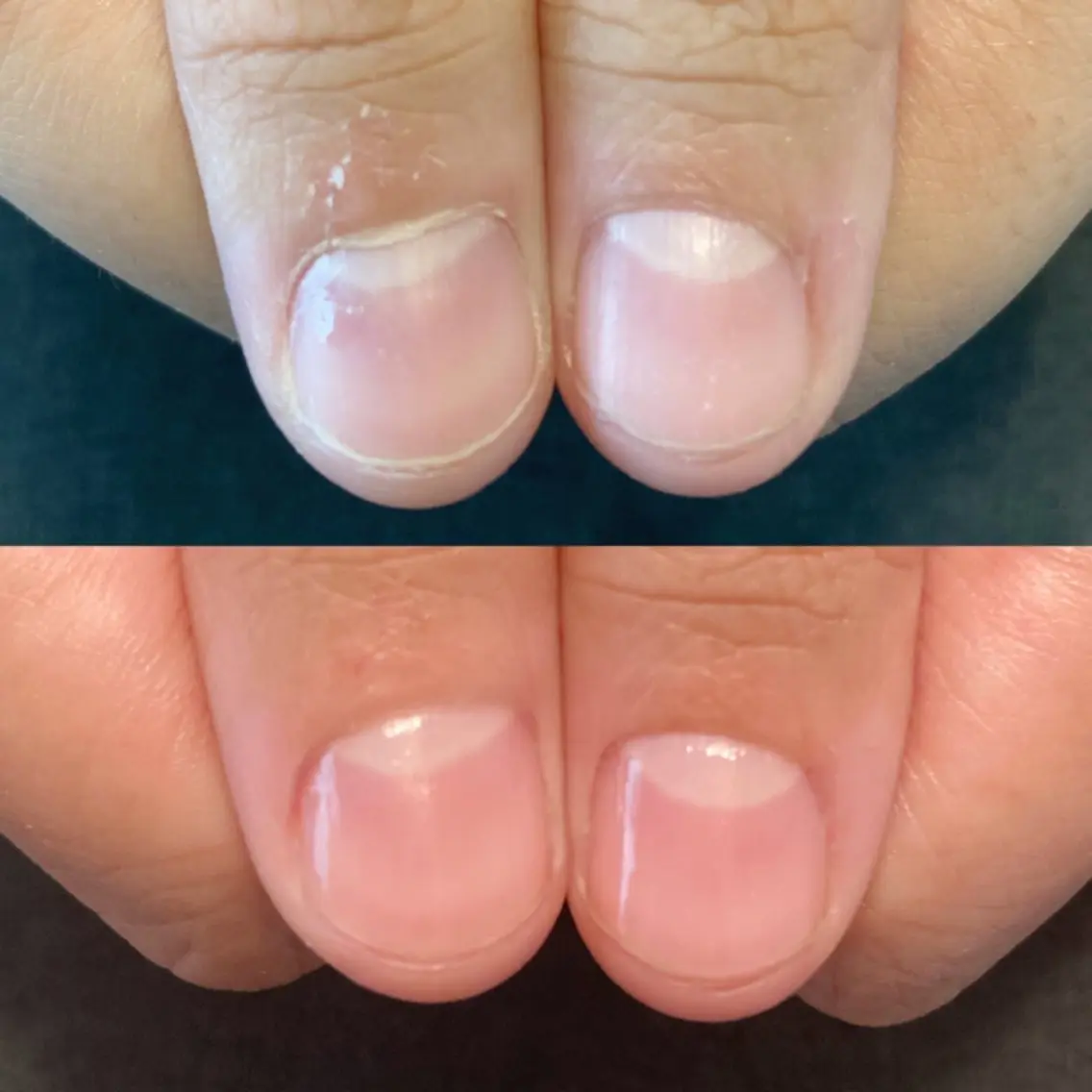 ネイル 地爪育成💅 kanaoanailのネイルデザイン