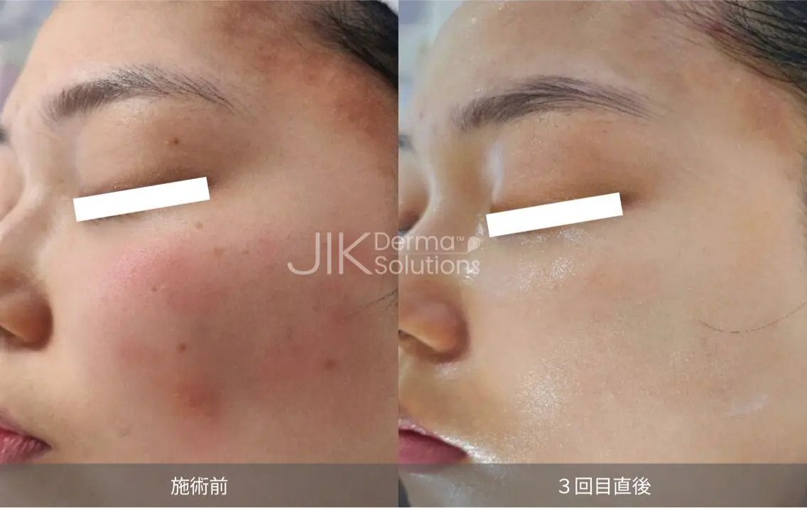 エステ esthesalon O'-en-のエステ・リラクイメージ
