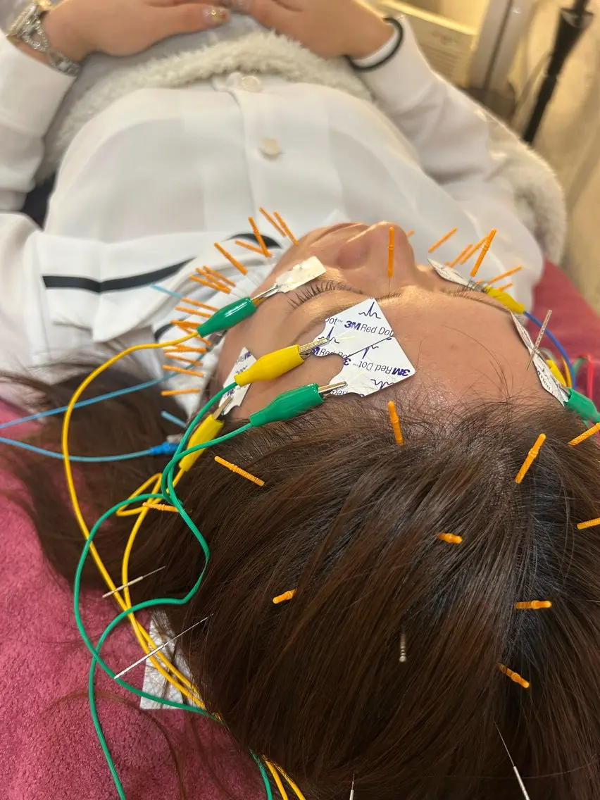 その他 美容鍼灸女性専用 りんご鍼灸治療院のその他イメージ