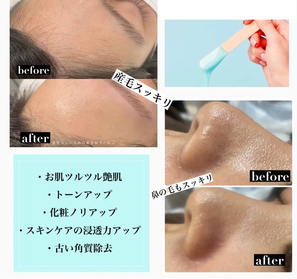 【産毛角質ケア★即ツルツル】フェイシャルワックス+うるおいパック付¥6,980→¥4,980の写真
