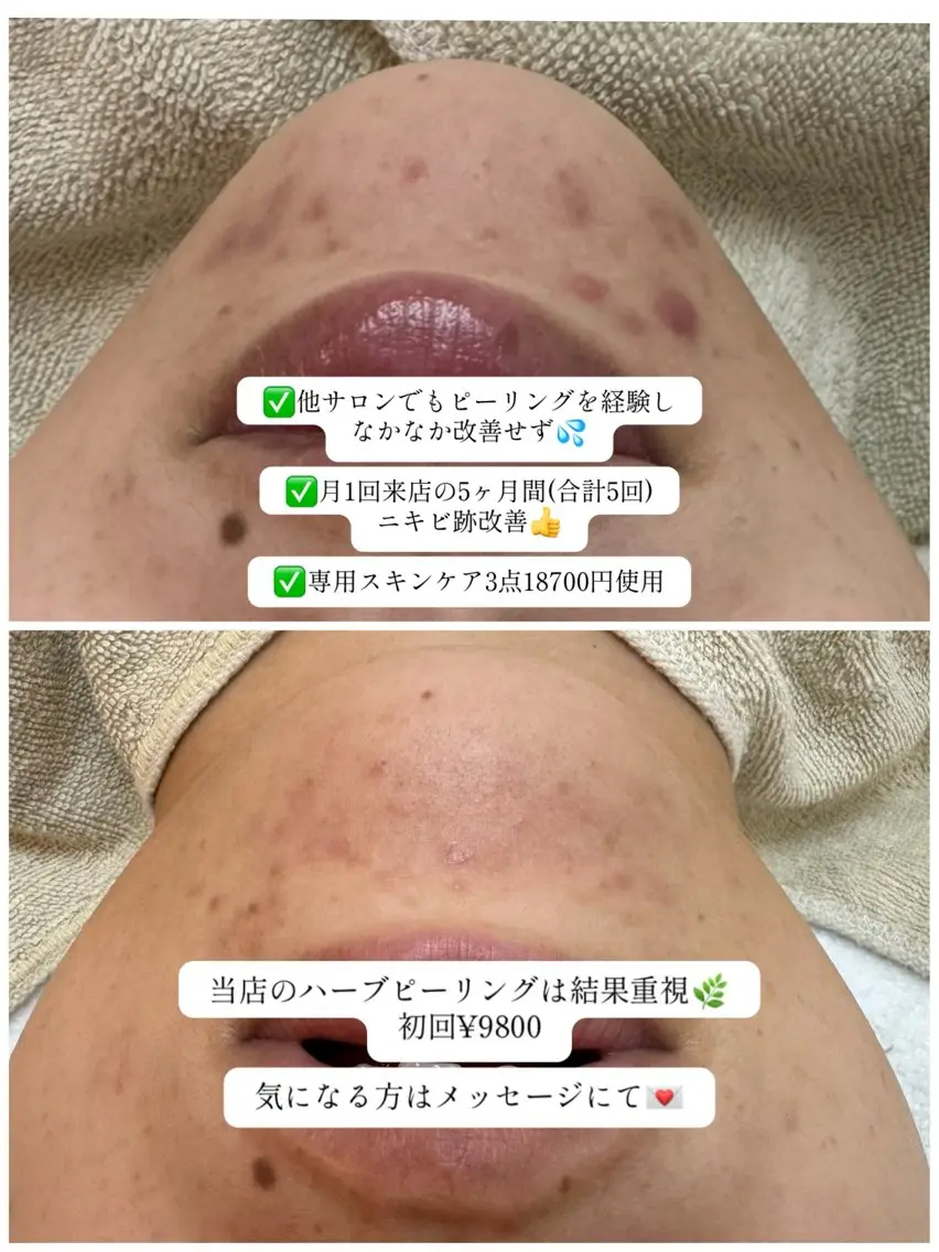 エステ リラク 寝る前に通える肌改善 専門サロンyuccaのエステ・リラクイメージ