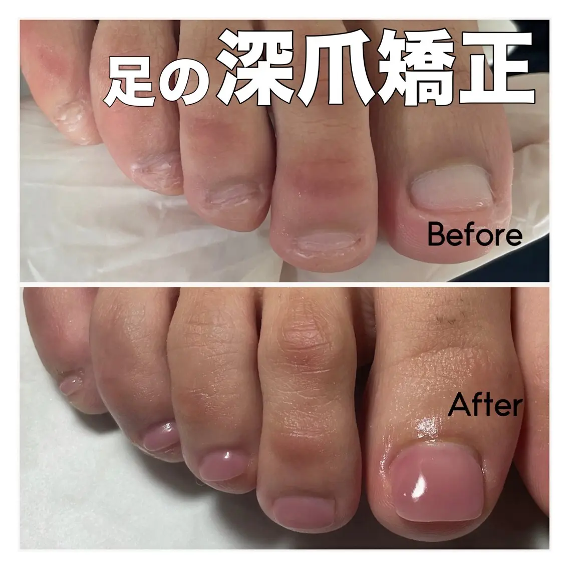 ネイル フットネイル ジェルネイル キラキラネイル フットネイル nail salon petillantのネイルデザイン