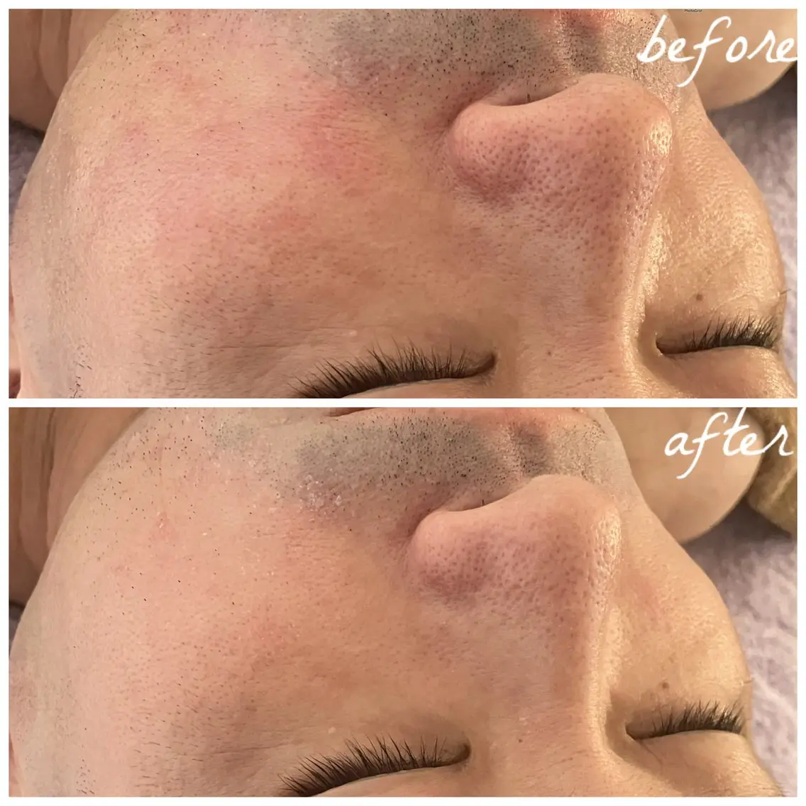 メンズ エステ メナード岐阜茜部 杉浦のエステ・リラクイメージ