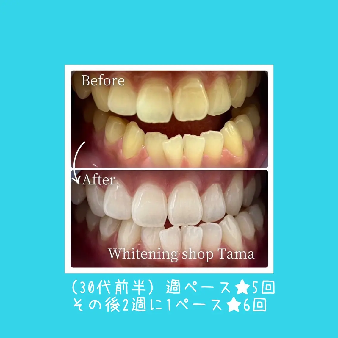 ミニモ限定【最初が肝心♪しっかりトーンアップ】回数券40分×10回(10来店)¥44,000の写真