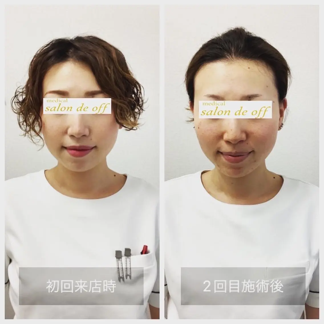 ハリサロンドオフ 美容鍼灸×小顔整体のエステ・リラクイメージ
