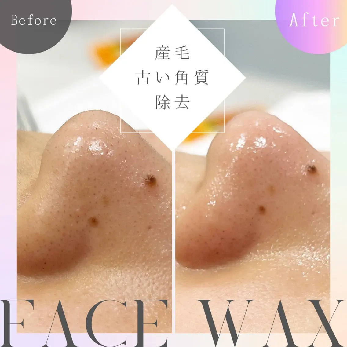 フェイスワックス(全顔)の写真