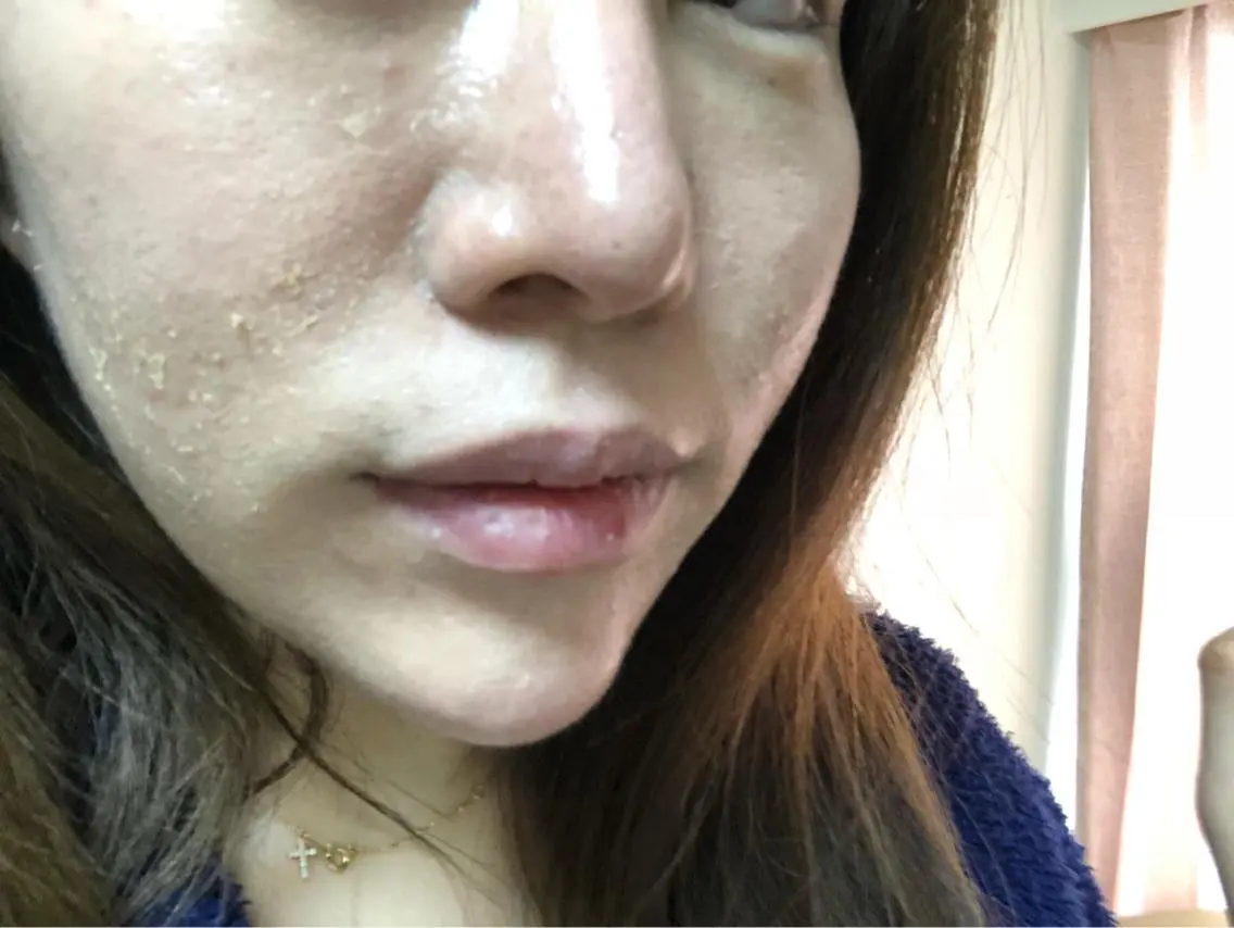 エステ ハーブピーリング専門 店⭐︎AI.HERBのエステ・リラクイメージ