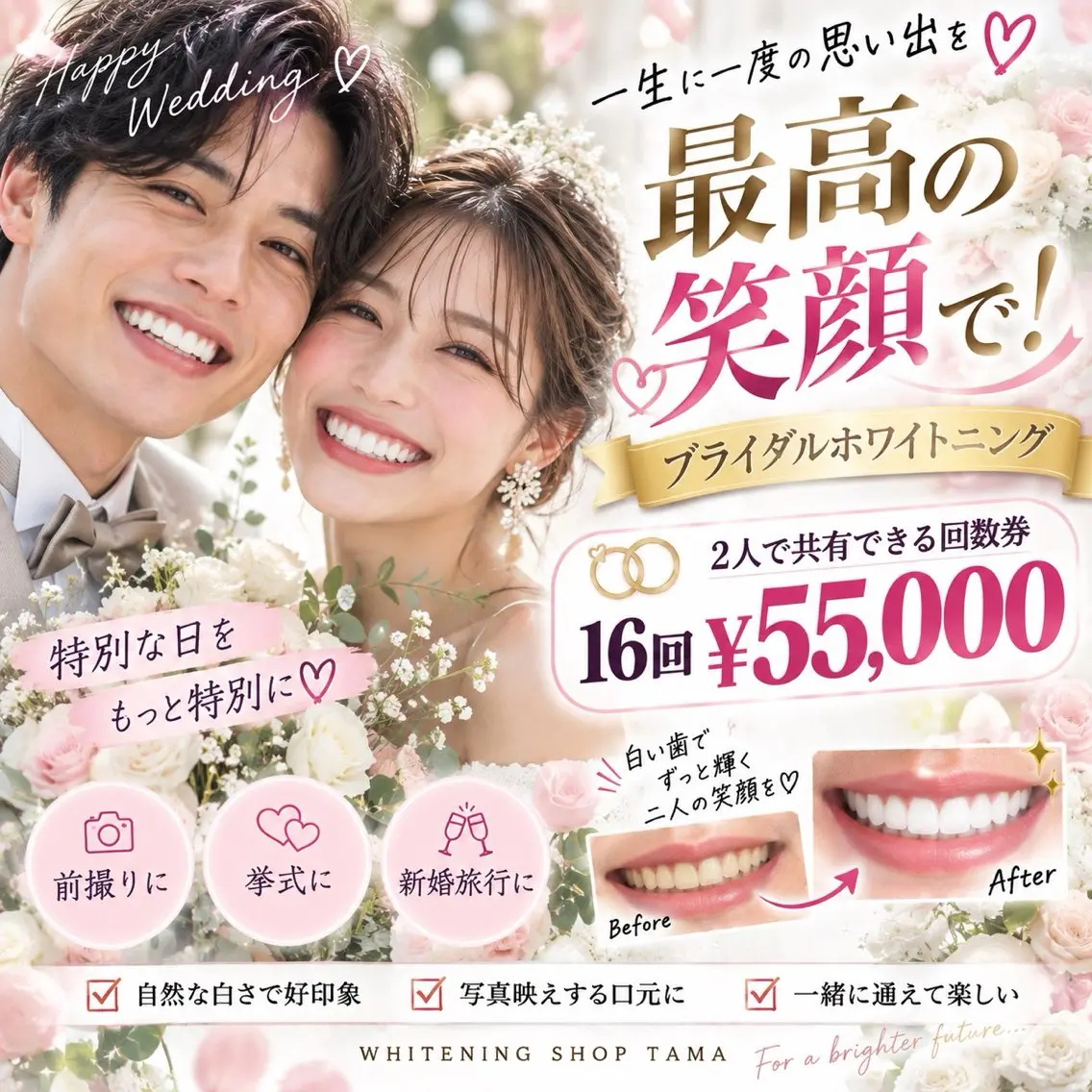 💍最高の笑顔で迎える結婚式✨2人で共有OK♡ブライダル16回券¥55,000🦷💕の写真