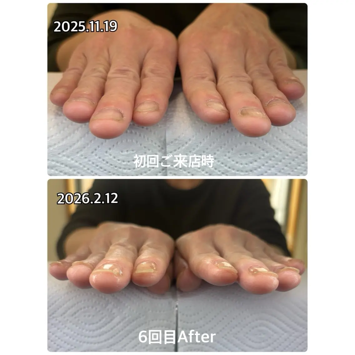 ネイル ハンドケア 高木 みどりのネイルデザイン
