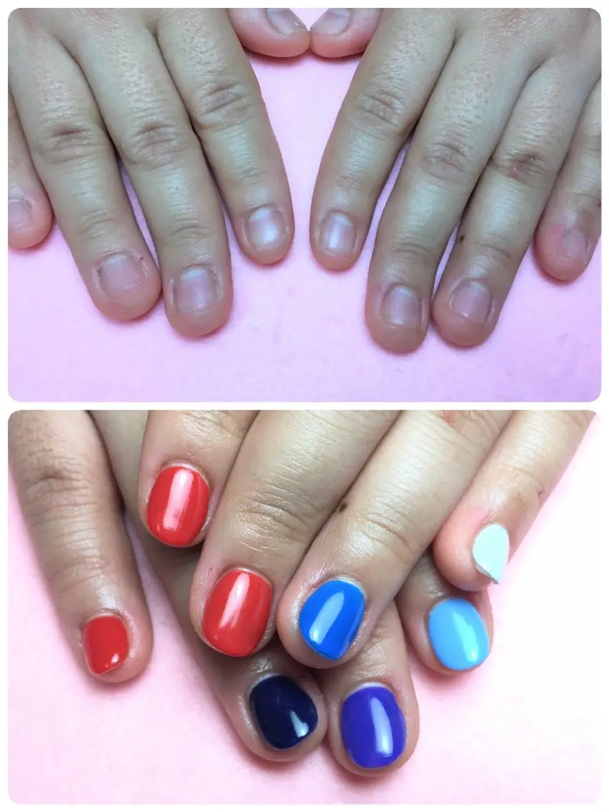 ネイル 長さ出し ハンドネイル ハンドケア 深爪矯正/爪育成ケア manie nailのネイルデザイン