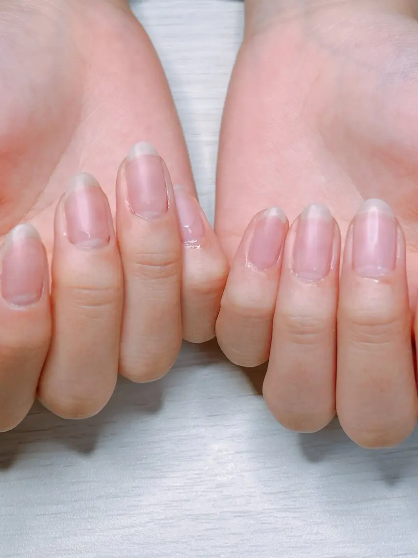 自爪風クリアネイルの写真