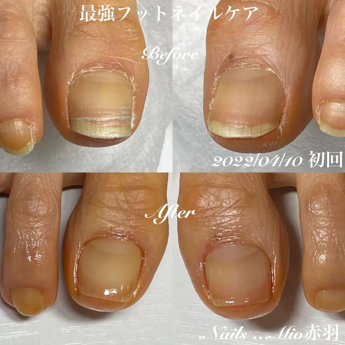 ネイル フットネイル .Nails Mio 赤羽西ネイルサロンのネイルデザイン