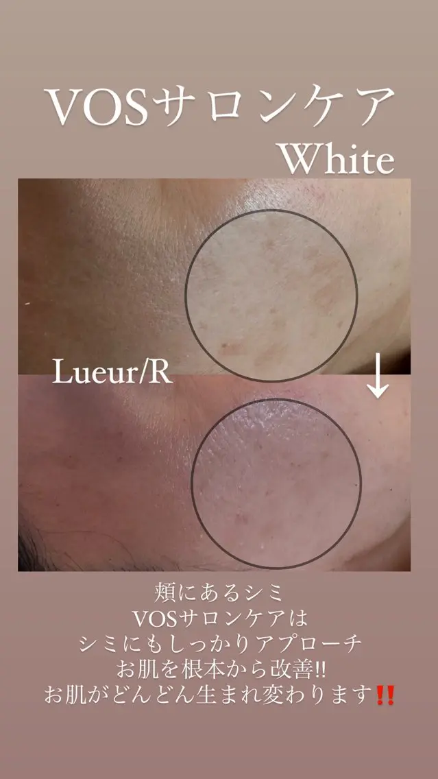 その他 大久保 里奈のエステ・リラクイメージ