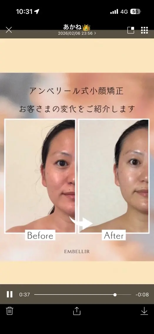 エステ 理想を叶えるサロン embellirのその他イメージ