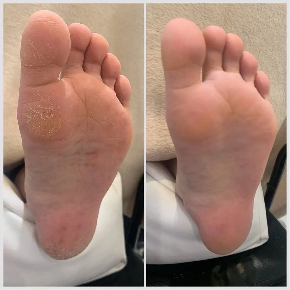 フットケア&足裏角質ケア&膝下保湿トリートメントコースの写真