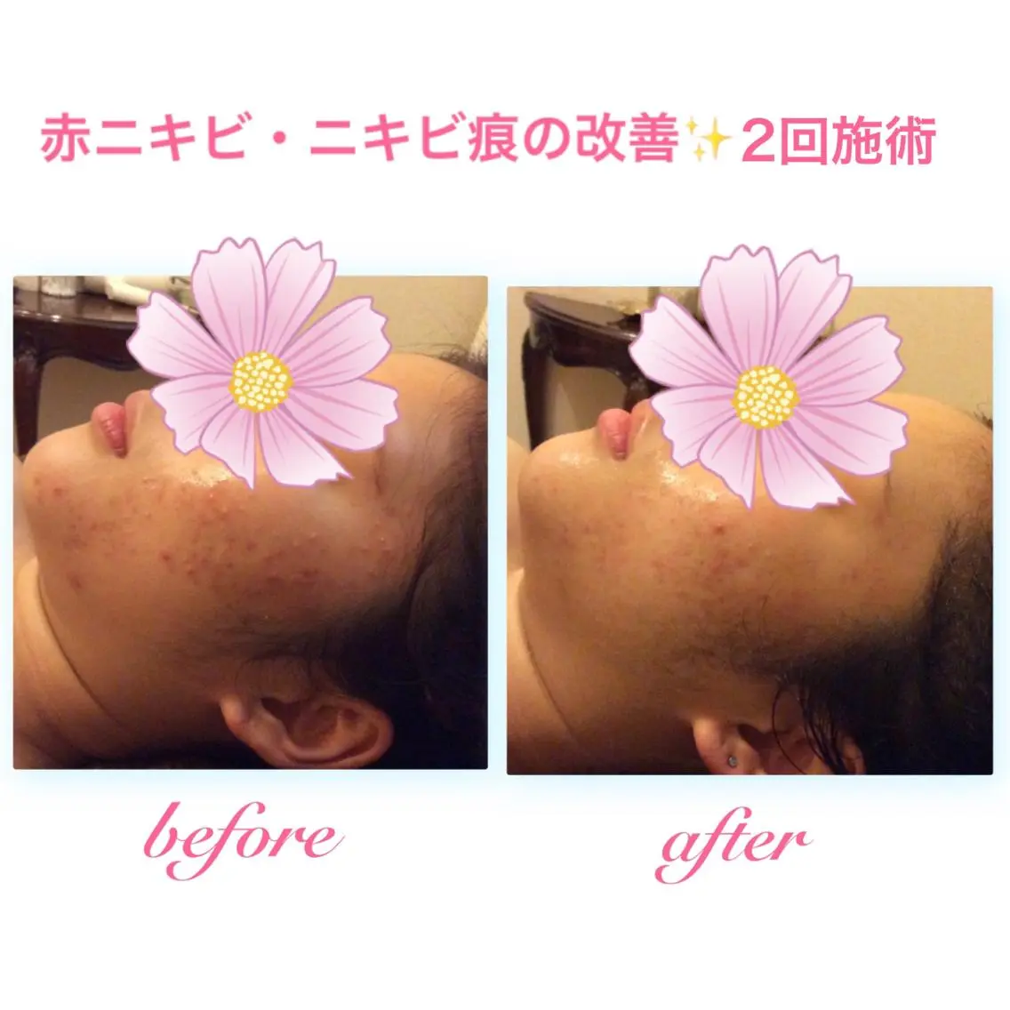 エステ リラク ダイエット・美肌ケア fleurのエステ・リラクイメージ