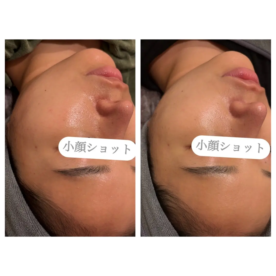 エステ 表参道エステ痩身 hiromiのエステ・リラクイメージ