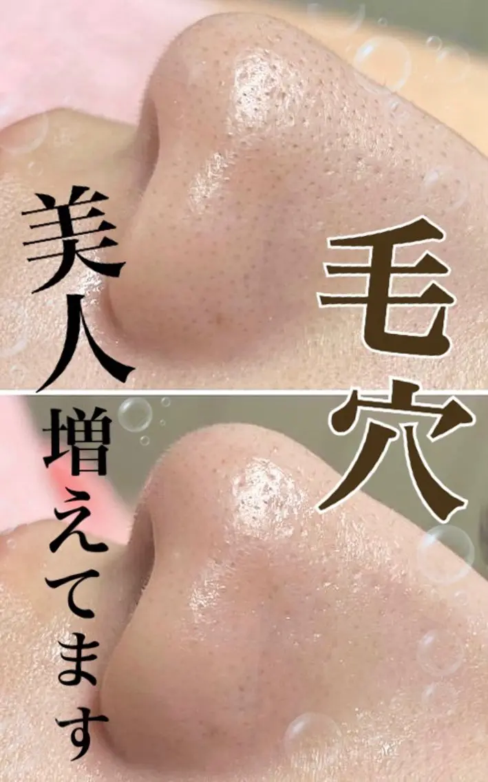Balance facialのその他イメージ