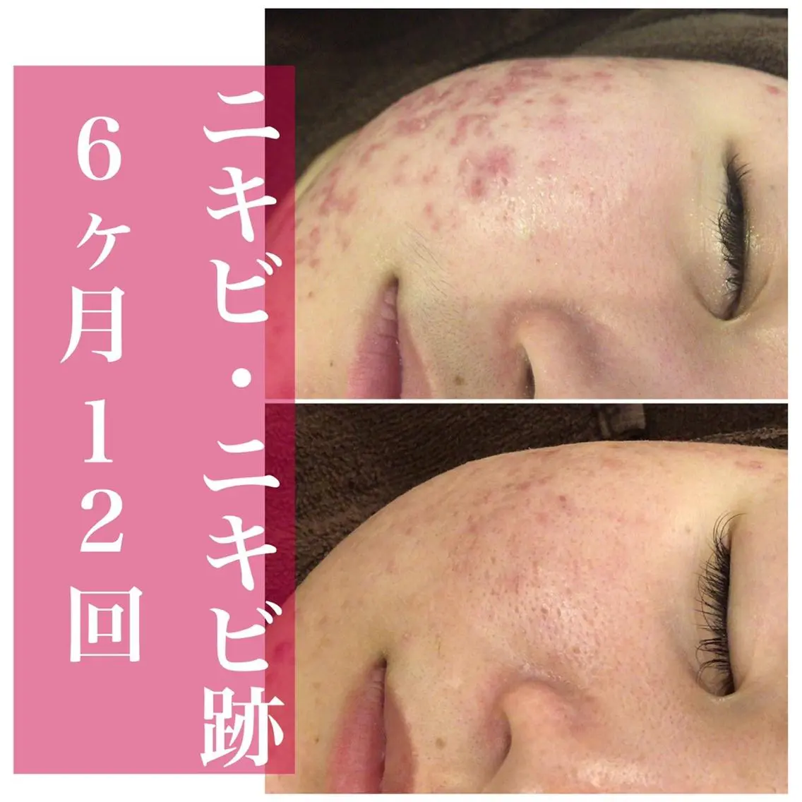 ミディアム パーマ ヘアアレンジ メンズ ネイル マツエク・マツパ アイブロウ ニキビ・肌質改善専門 ♡人生が変わるサロンのエステ・リラクイメージ