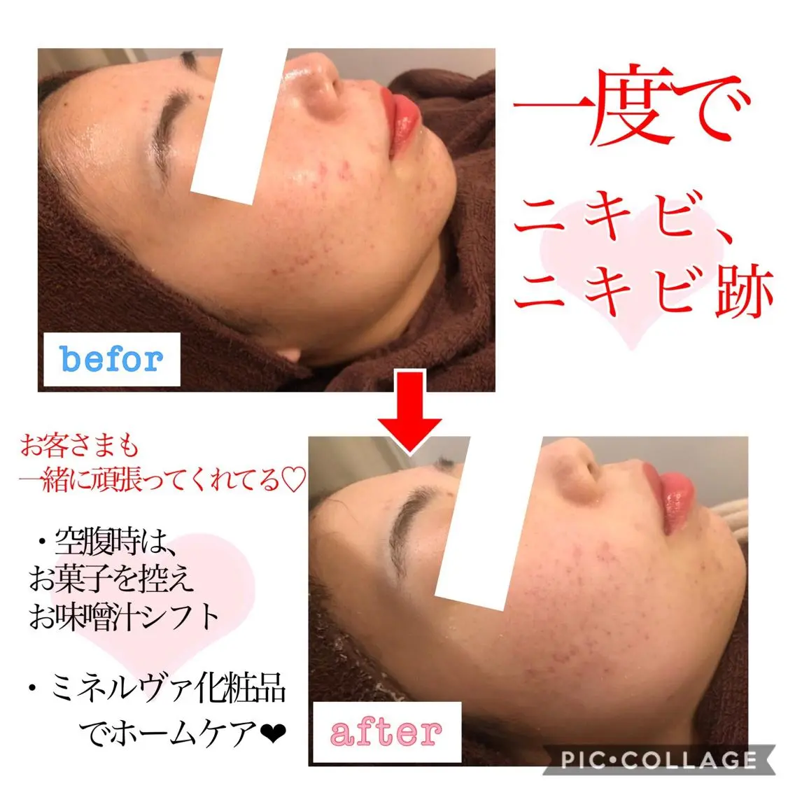 ショート カラー パーマ ヘアアレンジ メンズ キッズ ネイル マツエク・マツパ 金の糸脱毛 産毛ケア専門のエステ・リラクイメージ
