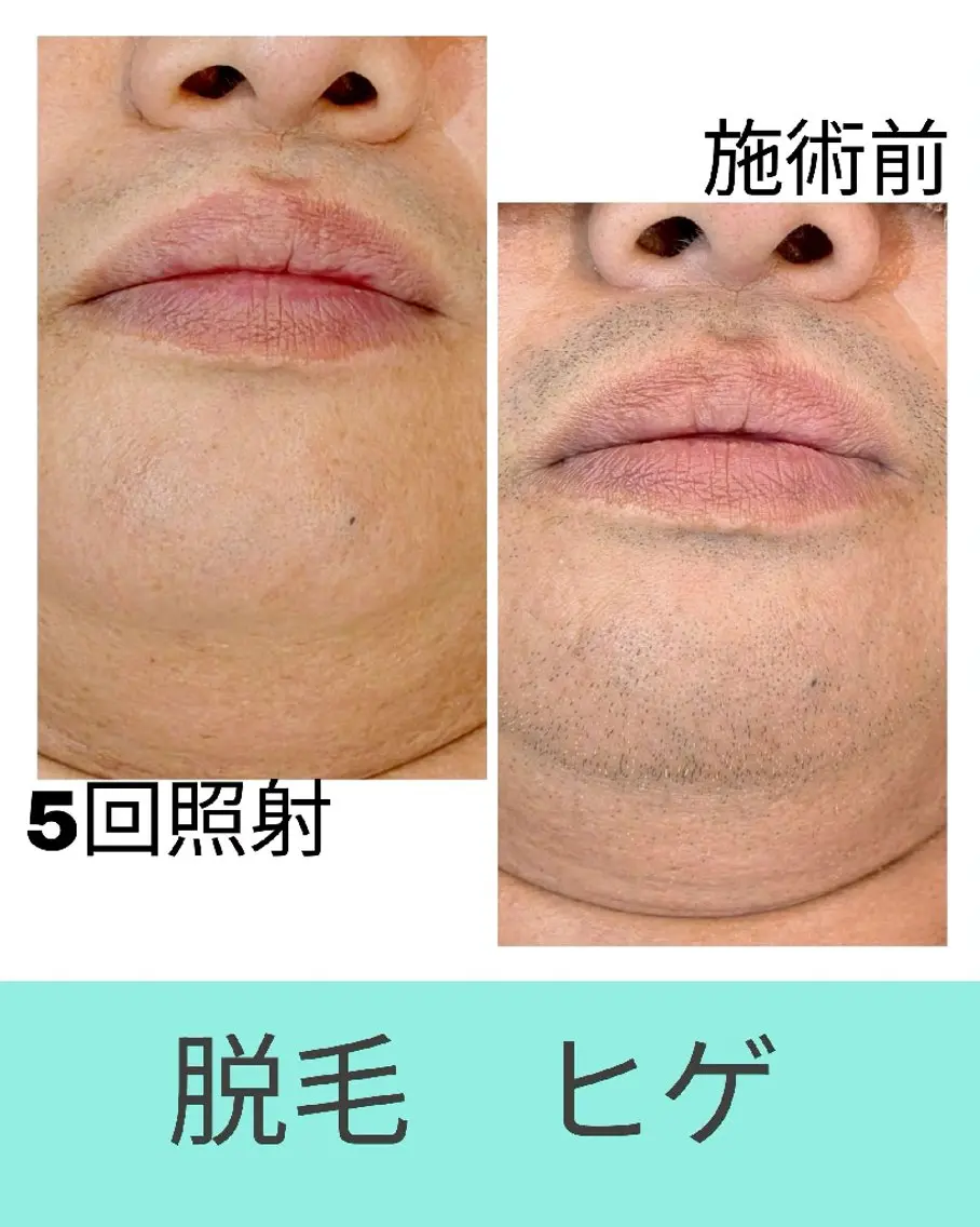 坂下 咲子のエステ・リラクイメージ