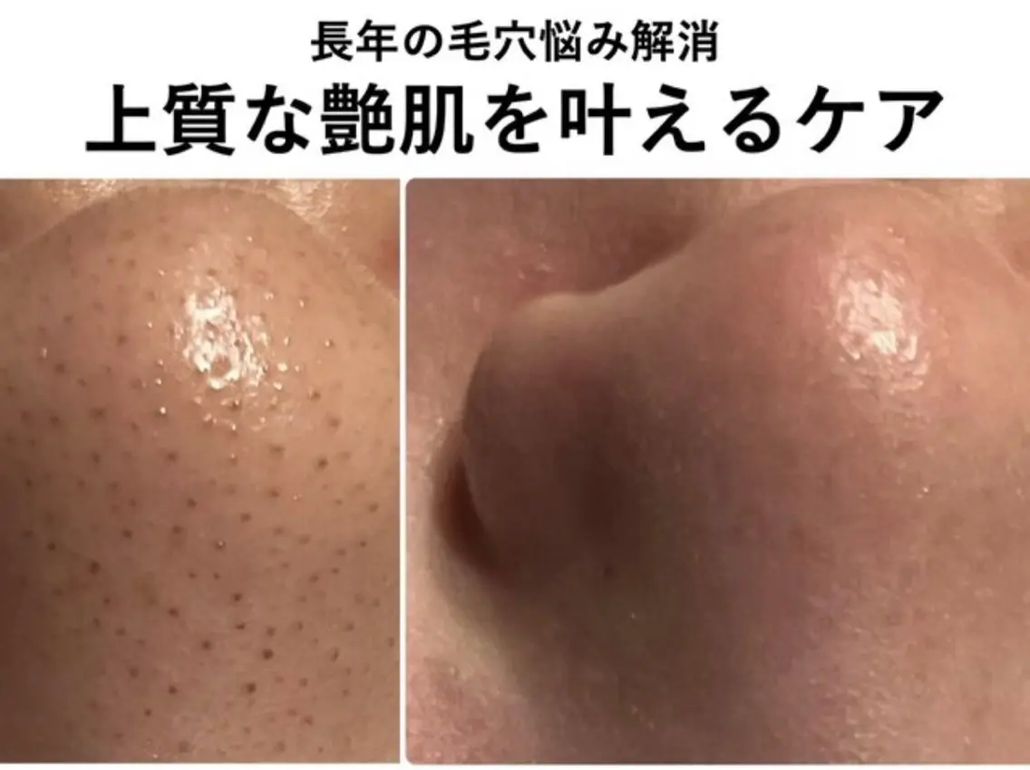 エステ ITO  SALON 小顔・痩身・肌質改善のエステ・リラクイメージ