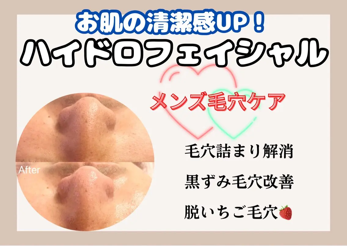 【いちご毛穴改善で清潔感UP】メンズ水素毛穴洗浄の写真