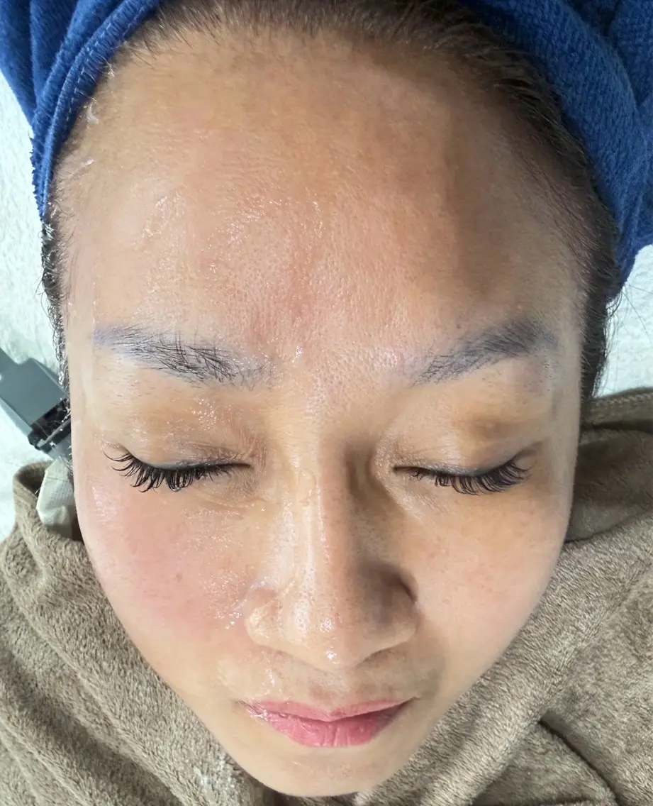 マツエク・マツパ エステ 愛維美 肌質改善サロンのエステ・リラクイメージ