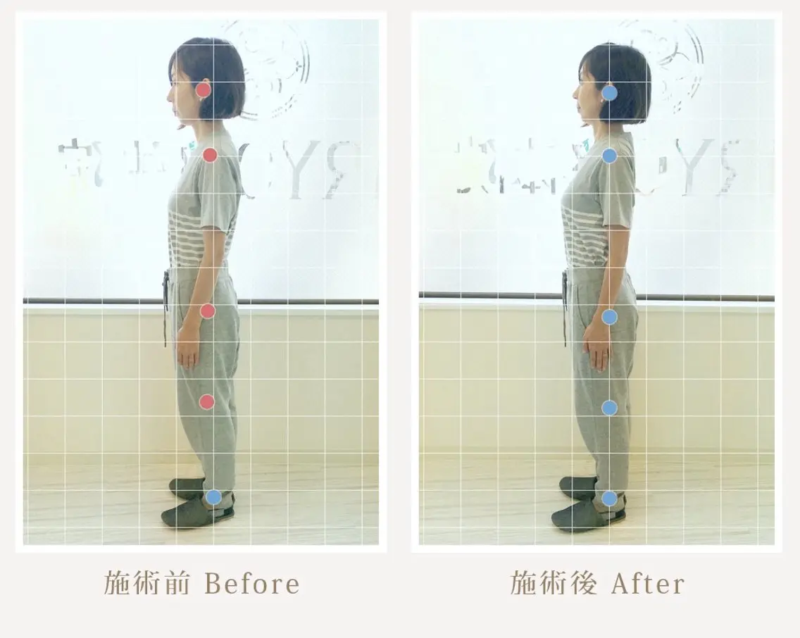 美姿勢矯正コース(スマホ首、巻き肩、猫背、肩こり、腰がつらい方、姿勢が悪くカラダの歪みが気になる方にオススメ)の写真