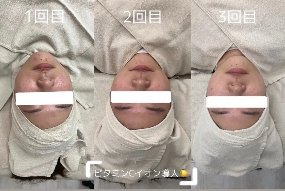 PRESS 中山のエステ・リラクイメージ