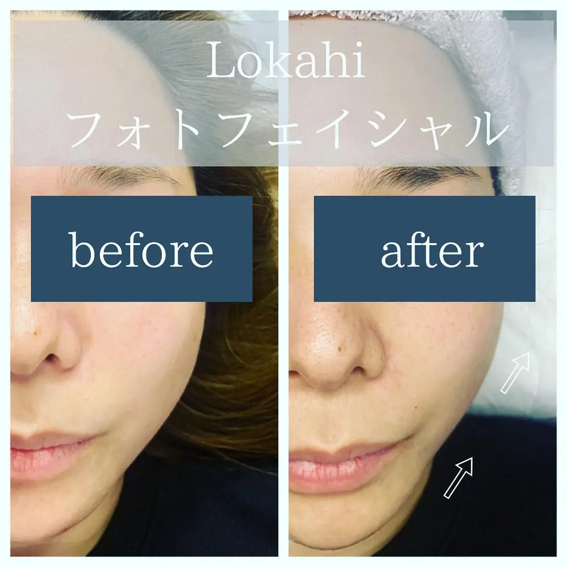 脱毛サロン Lokahiのエステ・リラクイメージ
