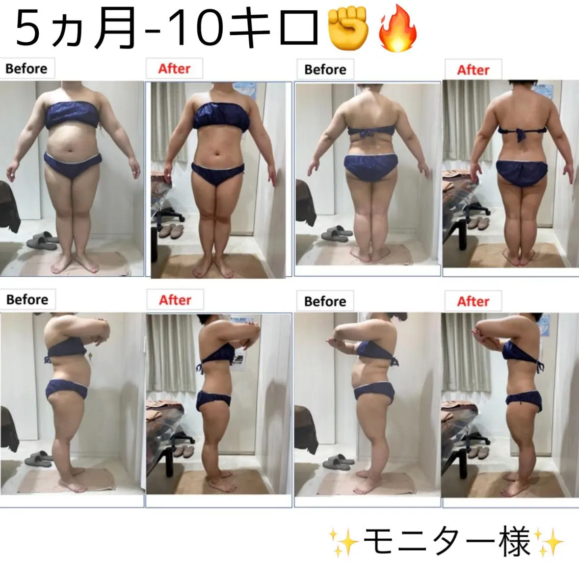 本気で痩せたい方に🔥全身痩身🔥夏に向けて徹底ケア🏖の写真