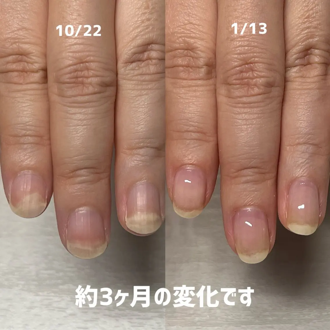 ネイル 自爪育成専門サロン ◌𓈒azumiのネイルデザイン