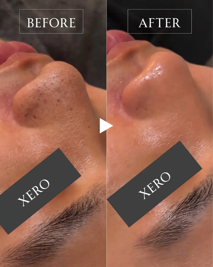 メンズ メンズ特化肌質改善 XEROのエステ・リラクイメージ