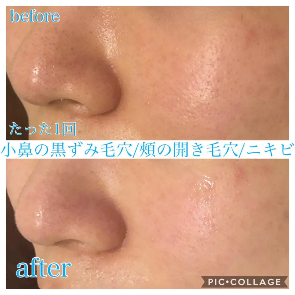 ロング カラー パーマ ヘアアレンジ キッズ ネイル マツエク・マツパ エステ リラク EnsorClair 代表 野口真央のエステ・リラクイメージ