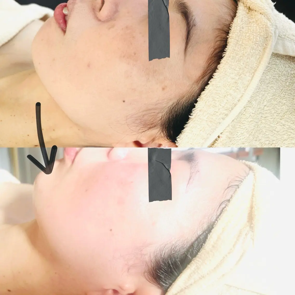 エステ beauty SalonRcoinのマツエク・マツパデザイン
