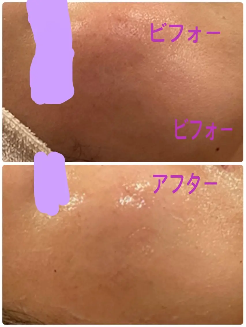 エステ Riossa Saoriのエステ・リラクイメージ