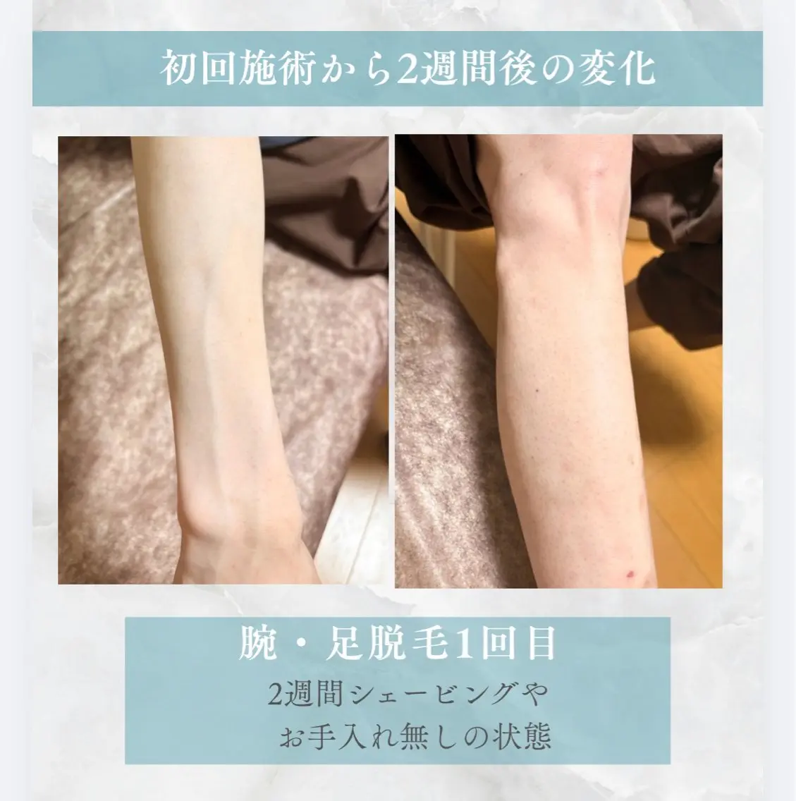 脱毛サロン moco selfのエステ・リラクイメージ