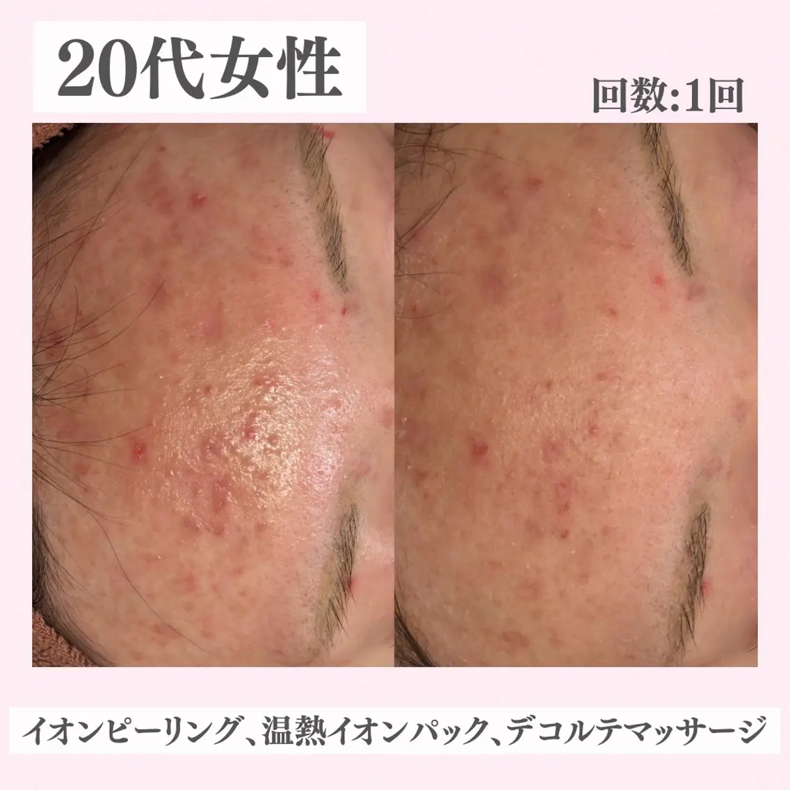 エステ リラク ニキビ・肌質改善専門 ♡人生が変わるサロンのエステ・リラクイメージ