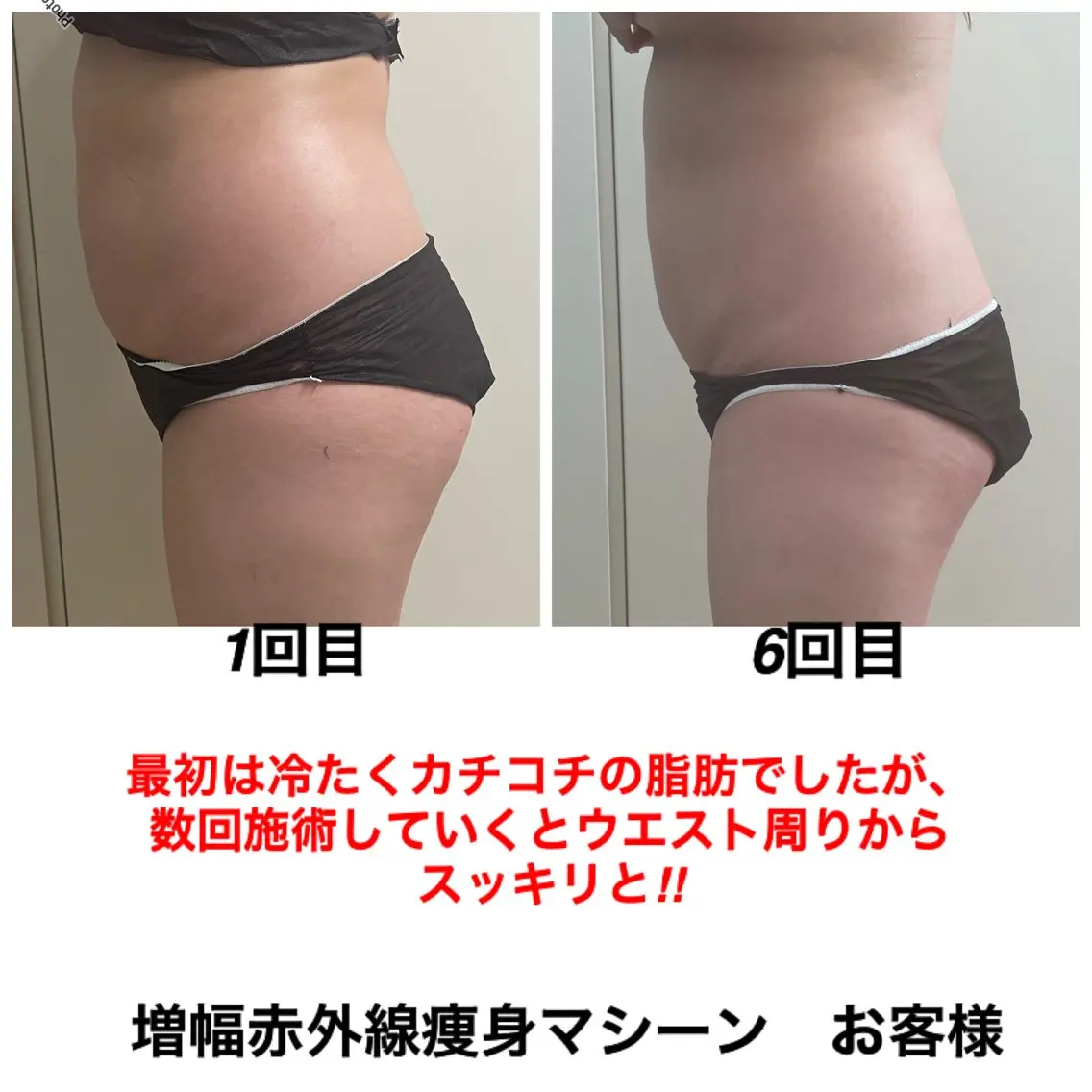 エステ ネイル・エステサロン UILANIのエステ・リラクイメージ
